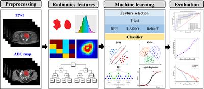 Prediction of Clinical Outcome for High-Intensity Focused Ultrasound Ablation of Uterine Leiomyomas Using Multiparametric MRI Radiomics-Based Machine Leaning Model